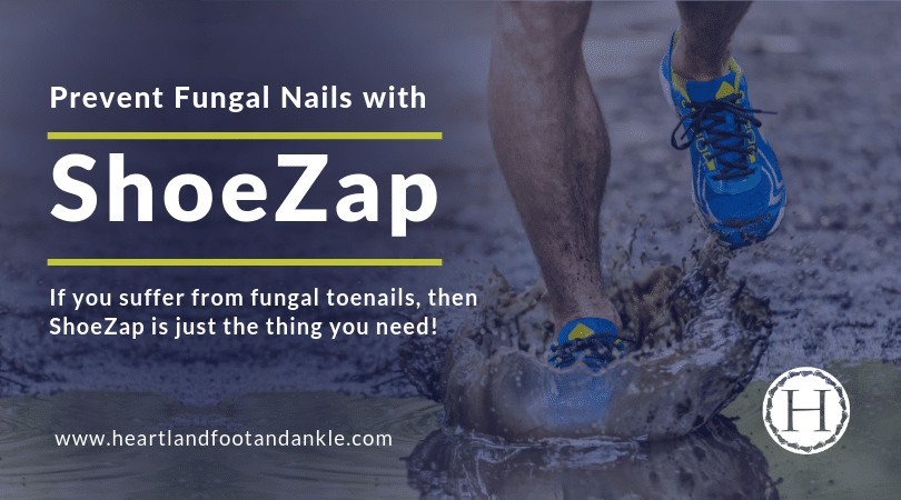 prevent fungal nails with shoezap graphic