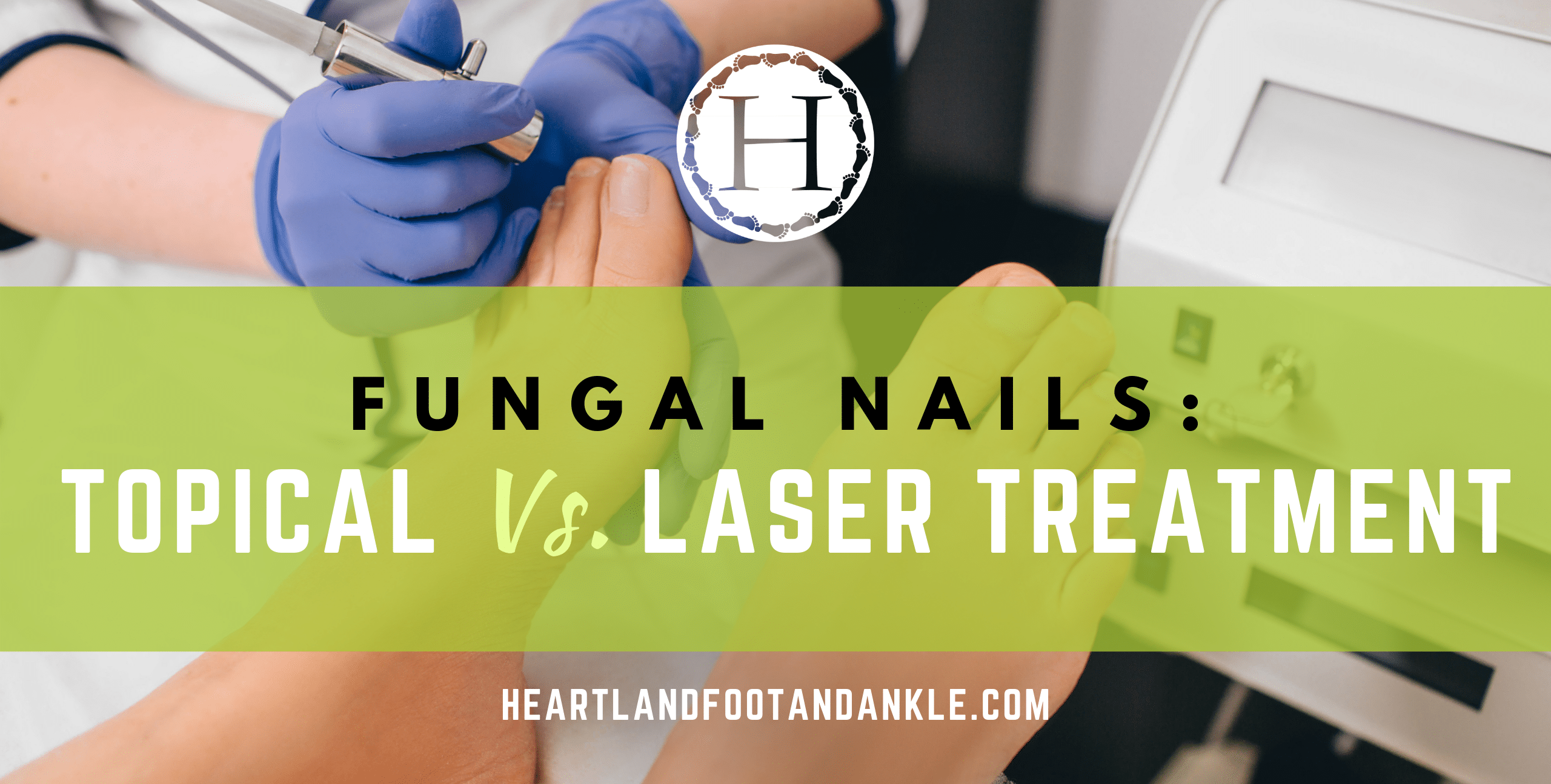 Topical vs. Laser Treatment