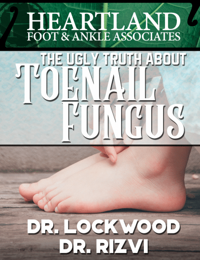 Toenail Fungus Guide