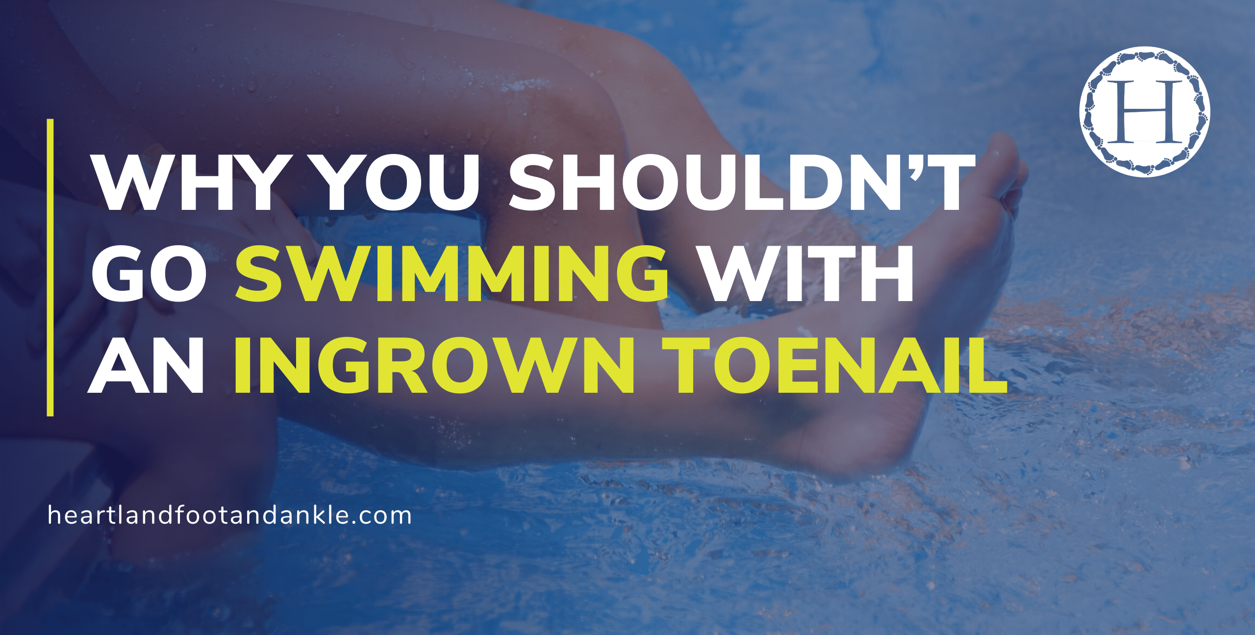 Don't go swimming with an ingrown toenail